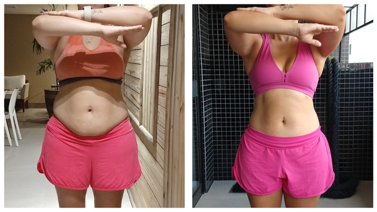 Antes x Depois 1