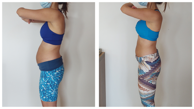 Antes x Depois 2