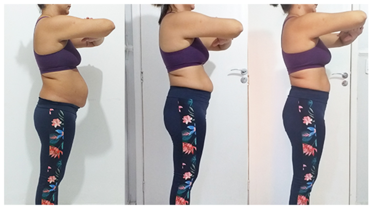 Antes x Depois 4