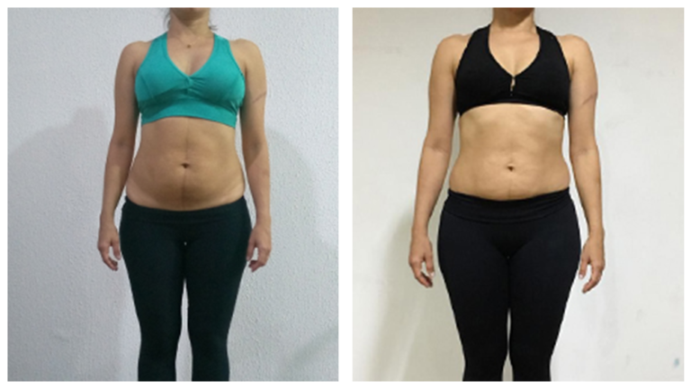 Antes x Depois 5